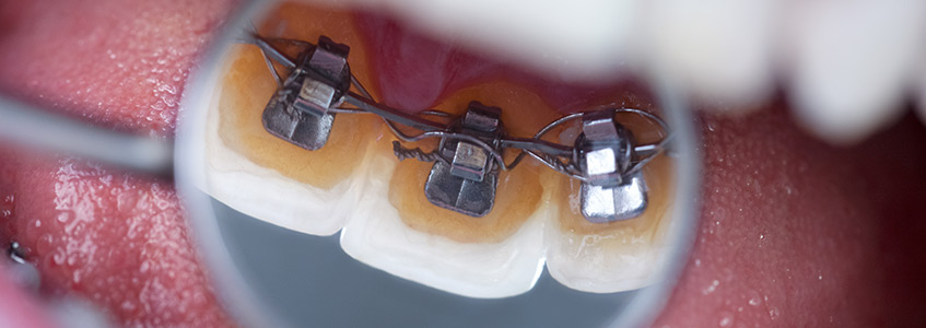 Orthodontics